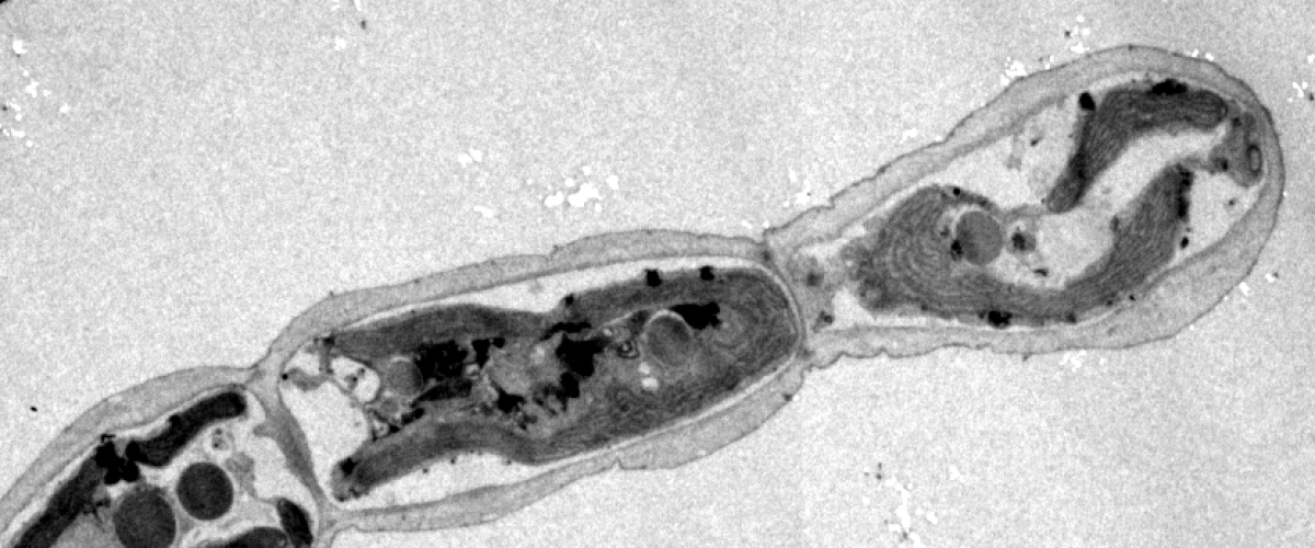 Ectocarpus apical cell - Transmission Electron Microscopy