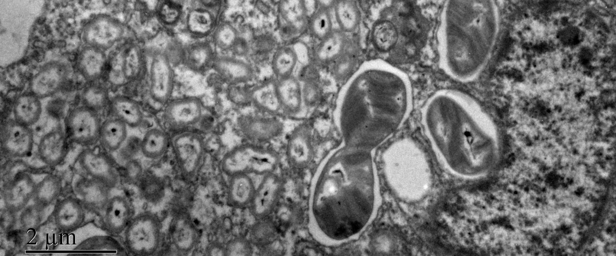 Abondantes bactéries symbiotiques de deux types dans la branchie de Bathymodiolus azoricus des sources hydrothermales de l'Océan Atlantique (microscopie électronique à transmission). 