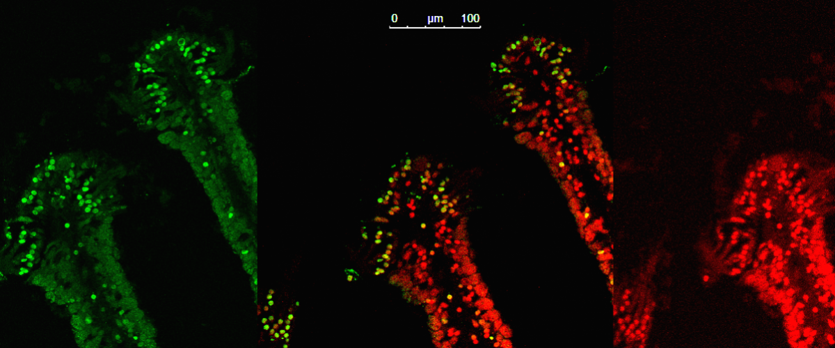 Marquage TUNEL (en vert) des cellules en apoptose dans la branchie de la moule Bathymodiolus puteoserpentis des sources hydrothermales de la Ride Médio-Atlantique (microscopie confocale).