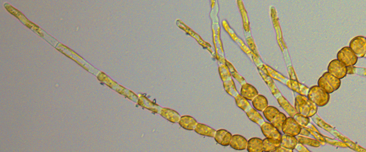 Ectocarpus Sporophyte displaying elongated and round cells