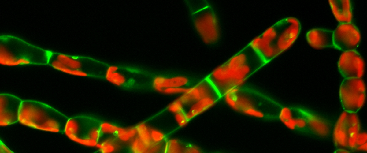 Lipid labelling and chloroplast auto-fluorescence