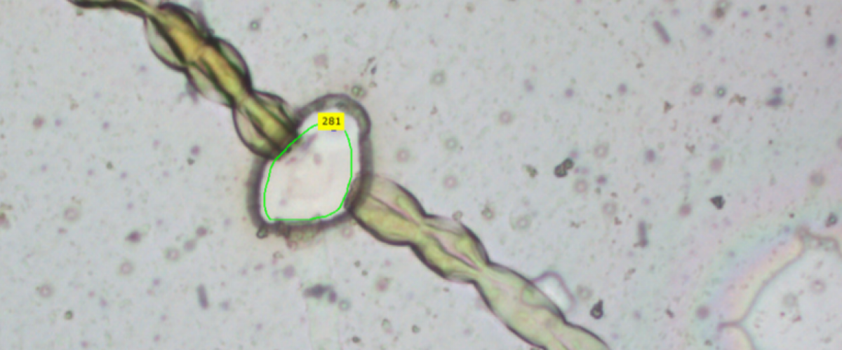 Laser Capture Microscopy