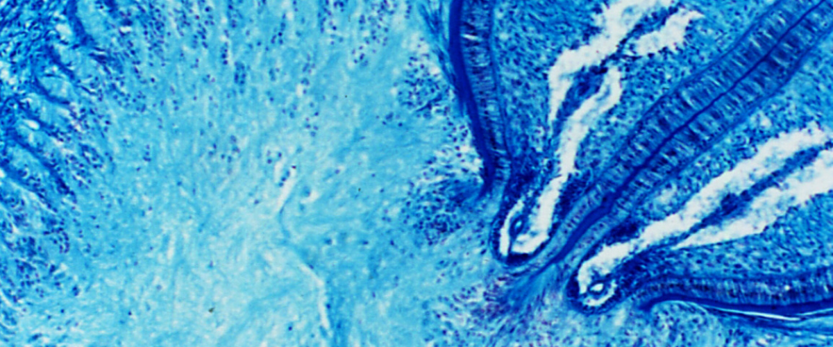 Coupe colorée transversale de la base de la branchie de l'Annélide Siboglinidae Escarpia southwardae des sources de suintements froids du Golfe de Guinée (microscopie optique).