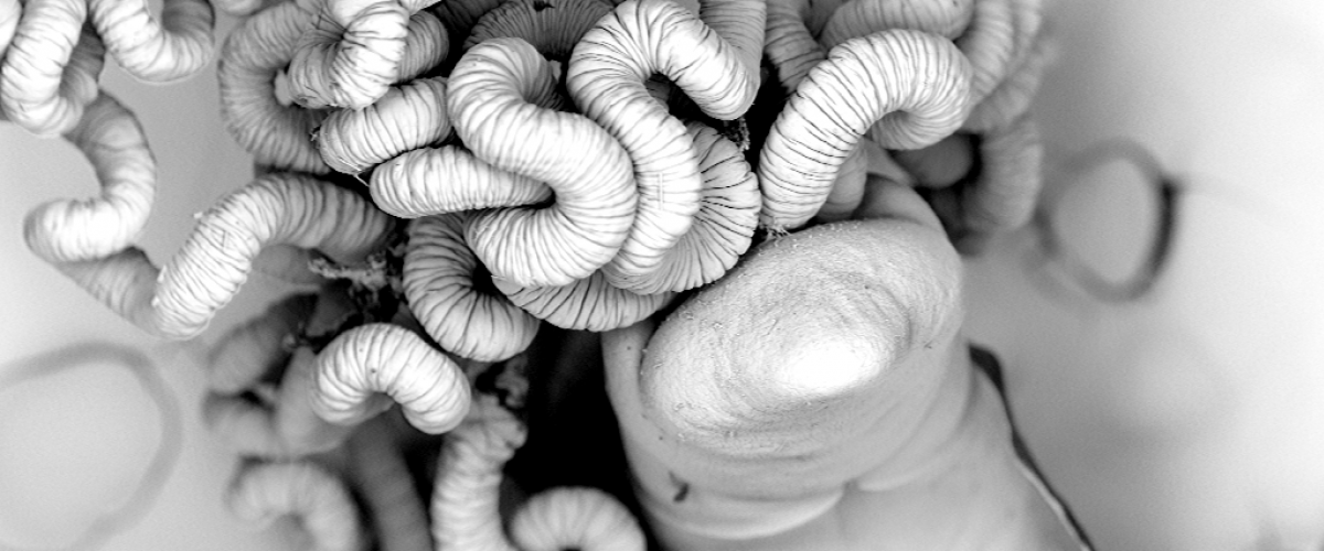 Tête et filaments branchiaux de l'Annélide Siboglinidae Oligobrachia de la Mer de Barents (microscopie électronique à balayage)
