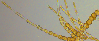 Ectocarpus Sporophyte displaying elongated and round cells