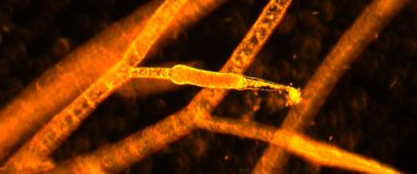 Ectocarpus sp - sporocystes pluriloculaires